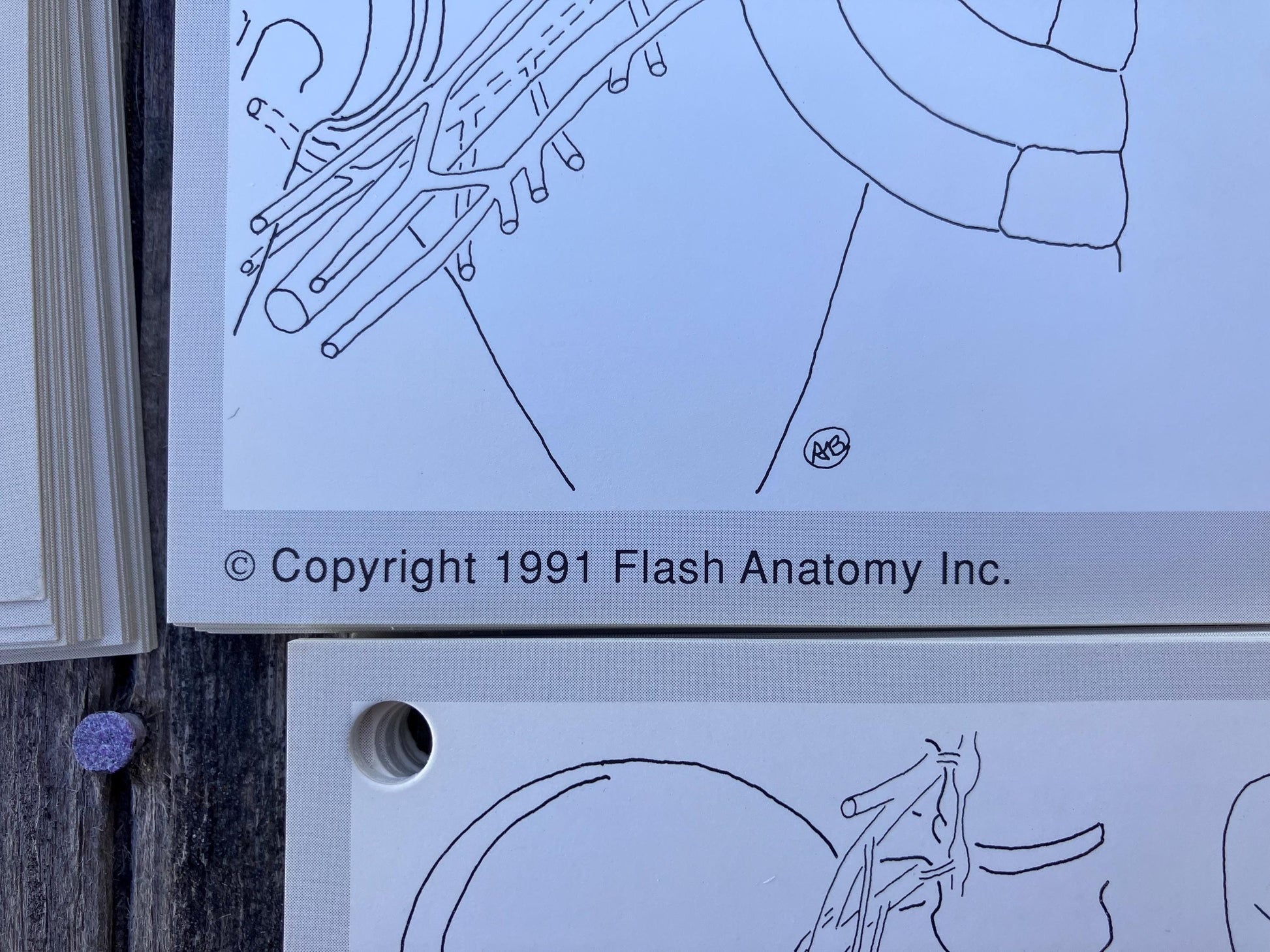 Flash Anatomy The Spinal Nerves by Andrew Paul Bonsall 1991 First Edition Vintage Flash Cards for Medical Students